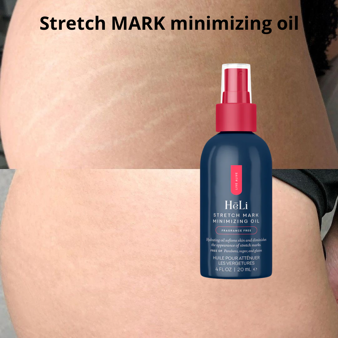 Stretch Mark minimizing oil